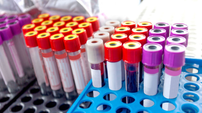 6b Gestión de bancos biologicos copia